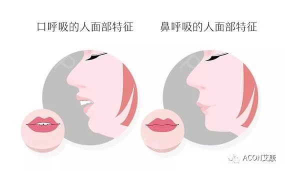 過(guò)敏性鼻炎會(huì)讓孩子變傻？！家長(zhǎng)該如何應(yīng)對(duì)